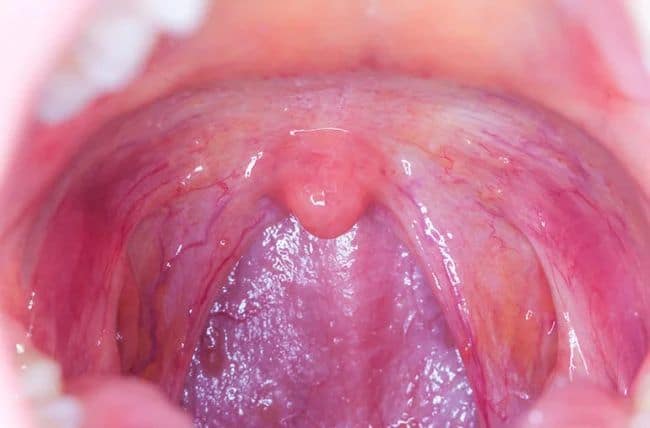 What’s the color for throat cancer?