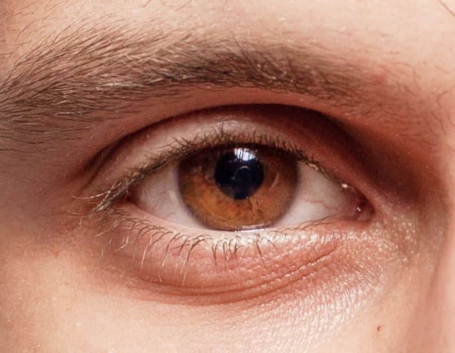 What are golden brown eyes called?