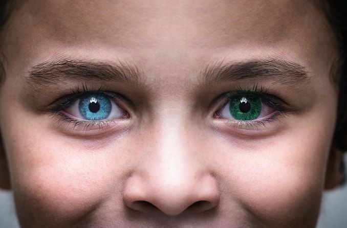 What is it called when your eyes are blue and green?