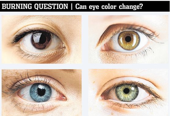 What is it called when your eyes change color randomly