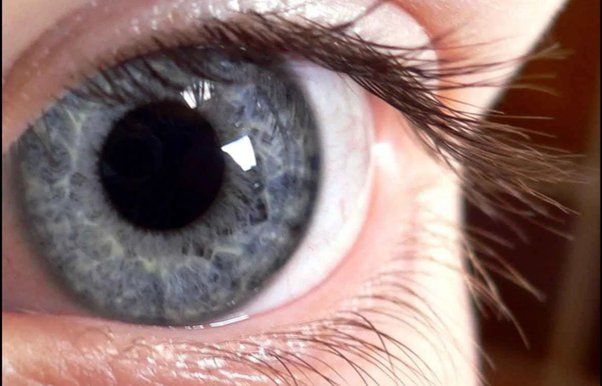 Why do blue eyes turn grey sometimes?