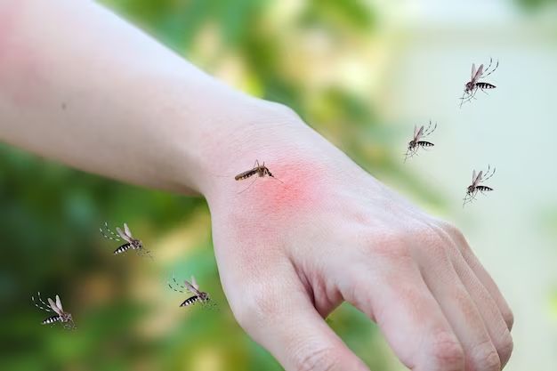 Do mosquitoes prefer a certain skin color